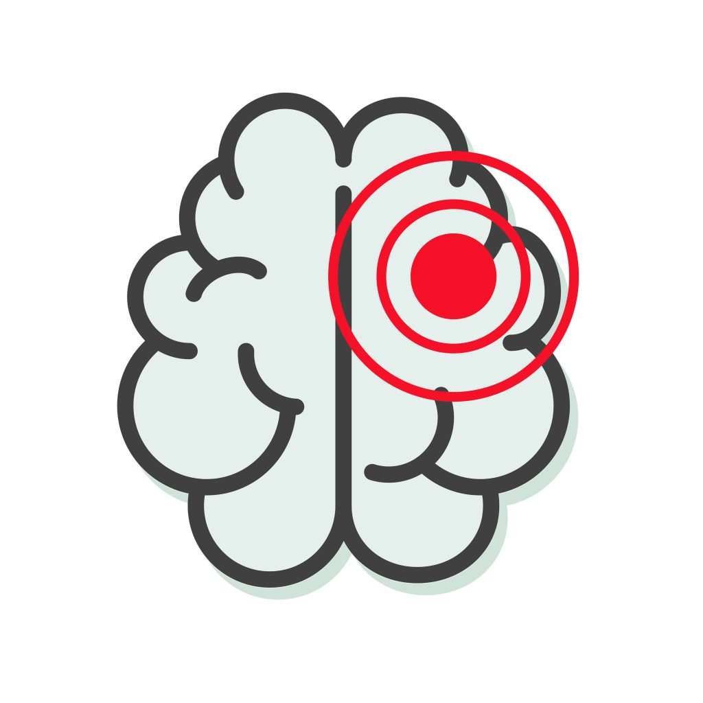 前頭側頭型認知症ってどんな症状なのかわかる脳のイラスト
