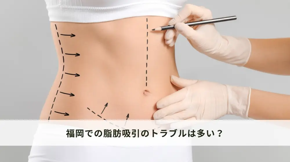 福岡での脂肪吸引のトラブルは多い？