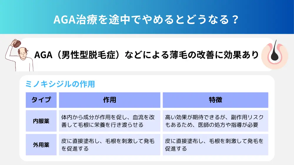 ミノキシジルとは？