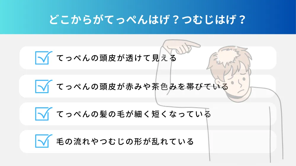 どこからがてっぺんはげ？つむじはげ？｜4つの判断基準